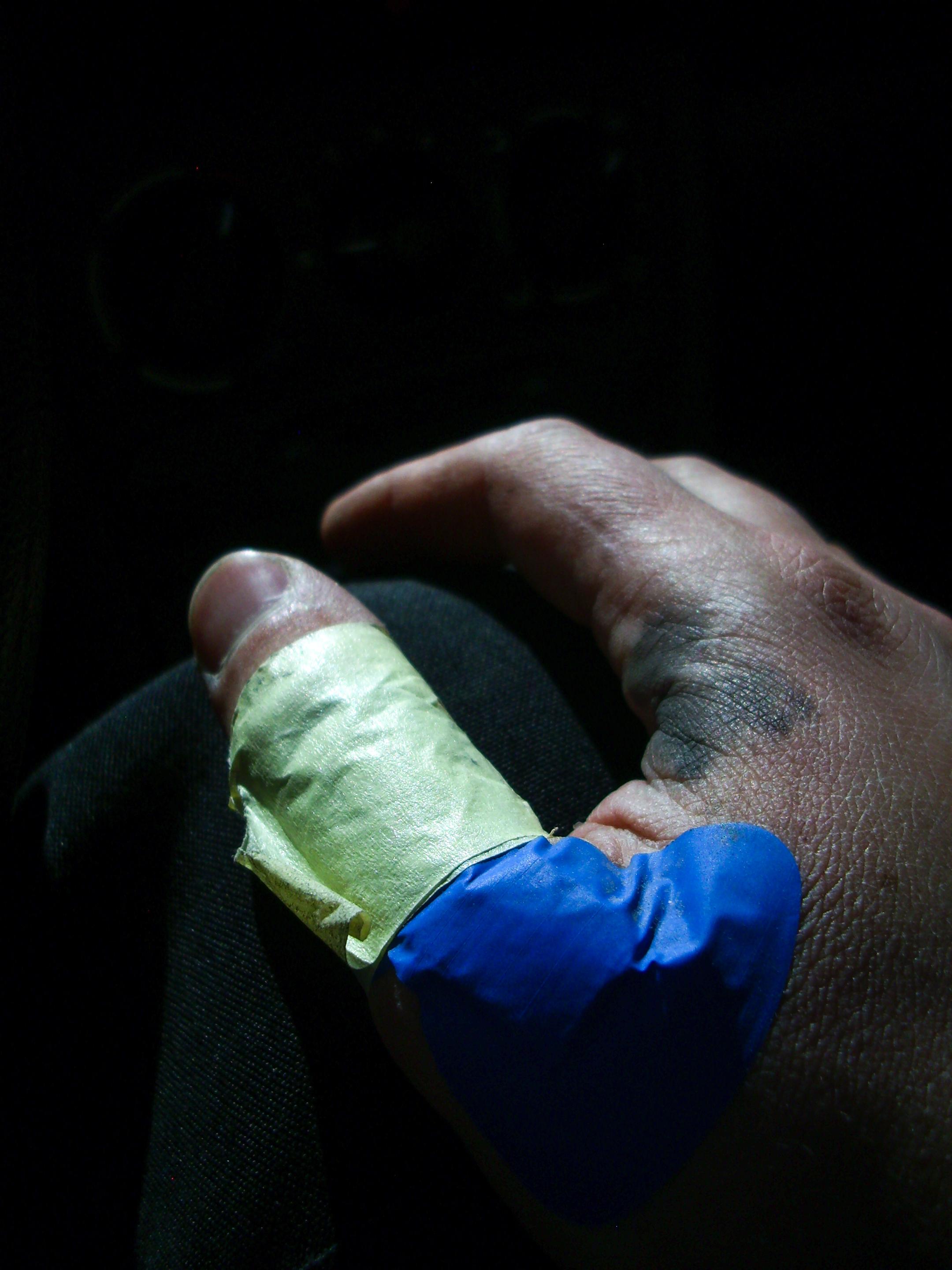 Chiaroscuro style closeup of my hand with a plaster on my thumb. Held tighter by paper painter's tape wrapped around it.
